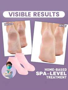 1 đôi tất dưỡng ẩm silicon tái sử dụng, với gót chân chống trượt bằng gel và thiết kế đàn hồi cao, được chế tạo đặc biệt để làm mềm gót chân khô, nứt nẻ và da thô ráp, dụng cụ chăm sóc chân unisex, thích hợp dùng với kem dưỡng da, món quà tuyệt vời. - a - Xem 7