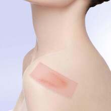 2pcs Silicone Scar Tape , Silicone Scar Sheets, Sheet For All Skin Types 0.39"X59.06" Inches Scar Gel Tape Roll, Reusable Silicone Scar Strip, Professional Use - View 3