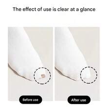 Socks Hole Repair Patches, Waterproof Clothing Repair Stickers For Down Jackets, Umbrellas, Washable Mending Patches - Multicolor - View 2