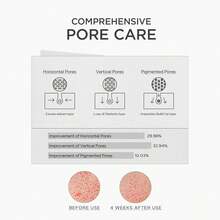 Skin1004 Madagascar Centella Niacinamide 10 Boosting Shot Ampoule 30ml / 1.01fl.Oz - 菸鹼醯胺 10% - 查看 4