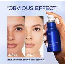 One Day Exosome Shot 2000 Facial Serum | Liquid Skin Booster Serum | Exosome, AHA+BHA+PHA | Pore Care, Dead Skin Cells, Skin Texture | Korean Skincare, Perfect Gift For Her - Exosome - Xem 2