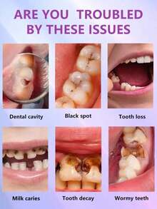 Teeth Cleaning Toothpaste Removes Tooth Stains Teeth Whitening Tooth Decay Repair Calculus Plaque Periodontitis Remove Cavities - 1件 - 查看 5