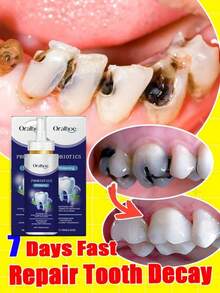 Teeth Cleaning Toothpaste Removes Tooth Stains Teeth Whitening Tooth Decay Repair Calculus Plaque Periodontitis Remove Cavities - 1PCS - View 2