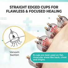 1 Set - 22/20/7pcs Thick Vacuum Cupping Set, With Manual Pump And Detailed Manual, Easy To Operate, High-Quality PS Material, Upgraded Sealing Design. Body Cupping Set, Beauty Cups, Anti-Cellulite - Arabic Packaging Box Set - Arabic Box - View 4