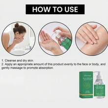 100g Gel calmante de Aloe Vera, hidratante y nutritivo para la piel después de la exposición al sol, apto para todo tipo de pieles - Gel de aloe vera - Ver 7
