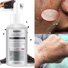 30毫升亮白黑米精华，蕴含烟酰胺抗衰老成分，平衡肤色，柔滑肌肤，即刻提拉紧致，多效合一。深层清洁保湿，令肌肤更显白皙透亮。每日使用，每周一瓶，沙龙级品质。[情人节、婚礼回礼、小礼物] - Hyaluronic Acid - 查看 3