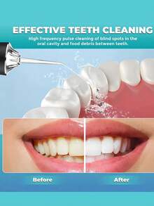 Power Dental Flossers - View 7