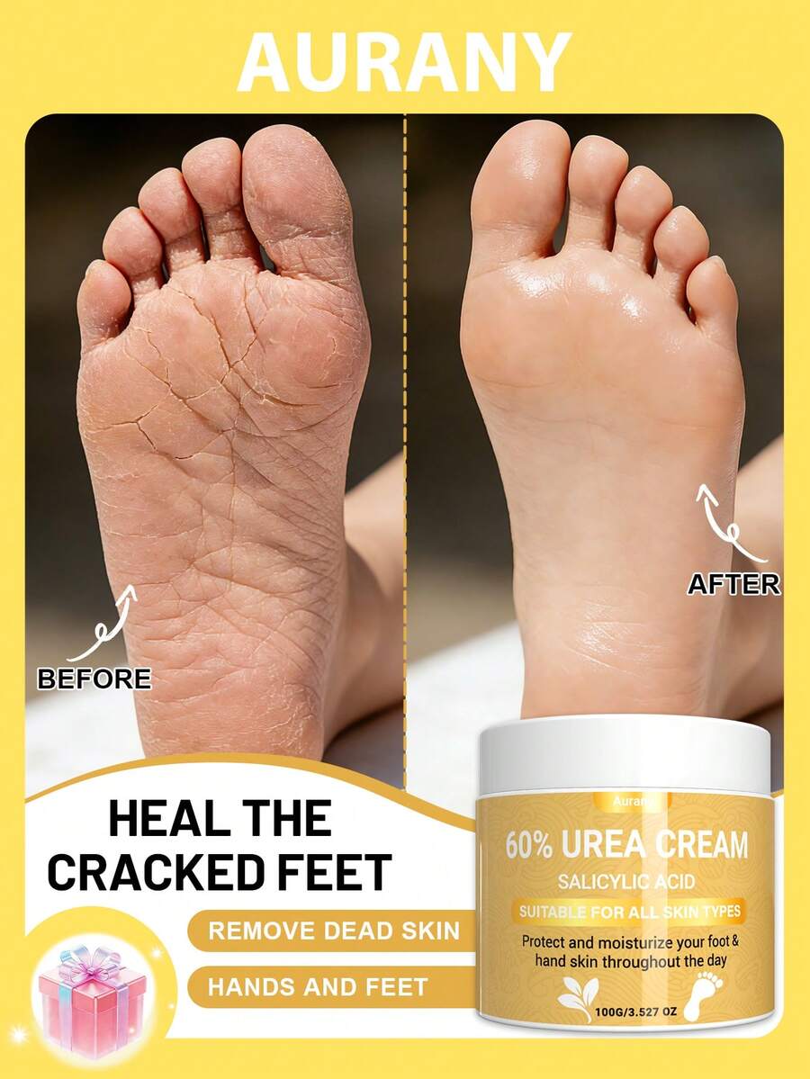 AURANY 60%尿素+水杨酸深层修护足霜，100克，去除老茧和干裂的脚后跟，持久保湿，男女通用，滋养并软化足部肌肤 - 無味 - 查看 1