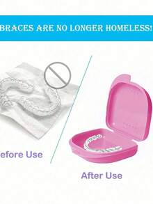 字母 A-Z 牙齿矫正保持器假牙粉色收纳盒，花朵字母装饰，牙套收纳盒，假牙盒，透气正畸牙套盒，保持器盒，牙科收纳盒，假牙放置盒，易于使用，方便携带，牙套矫正器矫正器盒，口腔卫生牙套收纳盒，家庭办公室宿舍用品，家居收纳用品，牙科配件 - 彩色 - 查看 9