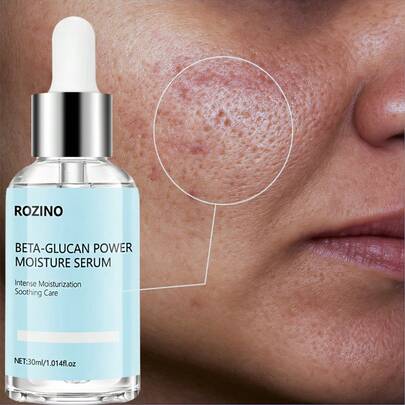30ml Suero de BETA-GLUCANO, que contiene ácido hialurónico, anti-envejecimiento, equilibra el tono de la piel, suaviza la piel, la tensa de inmediato, la ilumina, cubre el acné. Usar a diario, ilumina la piel en 1 semana. Calidad de salón, adecuado como regalo de San Valentín o favor de boda