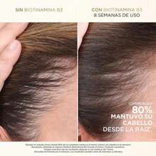 PANTENE, Tónico Capilar Anticaída+ para cabello saludable desde la raíz Pantene Biotinamina B3 Pro-V Miracles con Vitamina B3 y Biotina 52 ml - Blanco - Ver 4