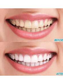 4/2pcs Manual Teeth Stain Remover & Polishing Set - Home Use Plaque Removal, Teeth Whitening, Alternative To Floss, Prevent Halitosis, Remove Tea Stains, No Power Needed, Suitable For Bathroom, Reusable And Washable - Multicolor - View 7