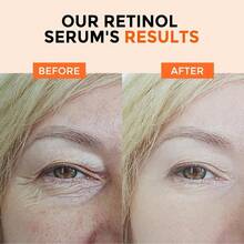 1瓶丽诗胶原蛋白精华，紧致、保湿、减少皱纹 - 彩色 - 查看 3