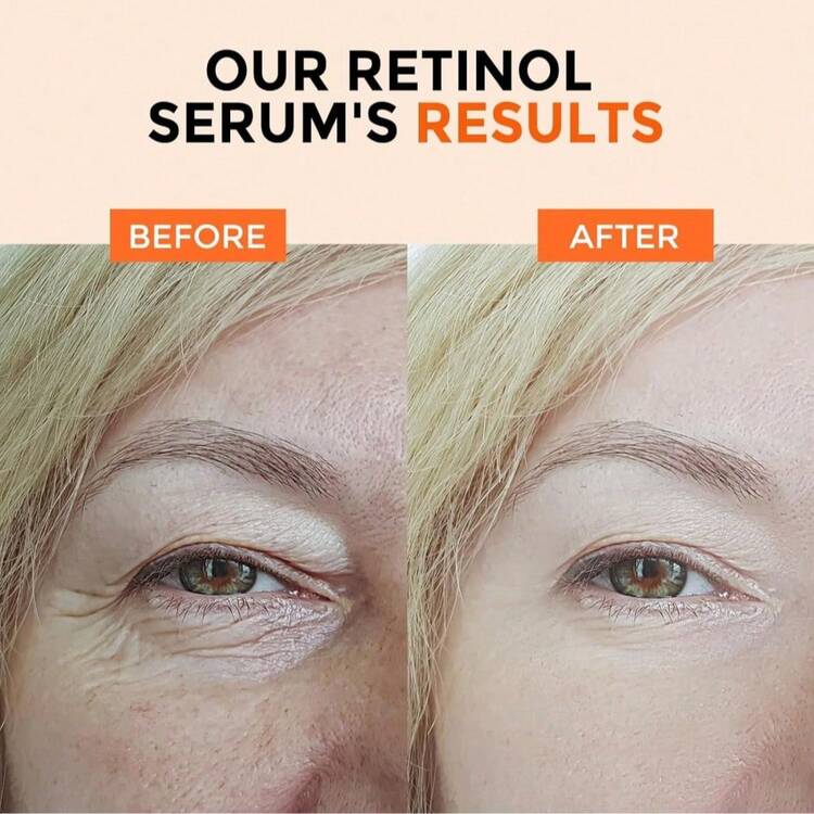 1瓶丽诗胶原蛋白精华，紧致、保湿、减少皱纹 - 彩色 - 查看 2