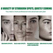 EELHOE Nicotinamide Intensive Spot Targeting Serum, Dark Spot Correcting Face Dark Spot Remover Freckle Removal Improves Facial Dullness Moisturizes Brightens Skincare 50ml - Niacinamide - View 2