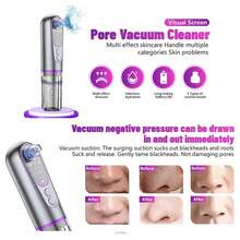 电动面部黑头去除器水洗吸尘器黑头吸出器毛孔清洁器面部水洗工具 500mAh - 查看 3