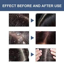 迷迭香薄荷头皮去角质刷，深层清洁头发，滋养保湿干枯秀发 | 滋养成分 | 物理去角质 | 清爽头皮护理 - 頭皮磨砂膏 - 查看 4