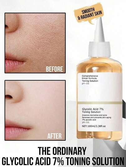 100ml 7% Glycolic Acid Toner, Exfoliates, Minimizes Pores, Revitalizes Skin (3.38 Fl Oz)