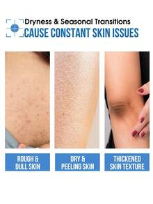 Vaseline Sanfte Feuchtigkeitslotion, geeignet für empfindliche Haut, repariert die Barriere, lindert Trockenheit, zieht schnell ein ohne fettig zu sein, nährt und befeuchtet tief, baut Hautbarriere wieder auf, verbessert Hautverteidigung, stabilisiert Hautstruktur, rekonstruiert die schützende Schicht - Sanft zur empfindlichen Haut> - Übersicht 2