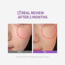 24 Expert Madeca Cream Active Renew PDRN（紧致霜，1.69 液盎司）——蕴含 TECA-PDRN、透明质酸和谷胱甘肽，具有弹性、舒缓和保湿功效的面部保湿霜，韩国护肤品 - 乳霜 - 查看 8