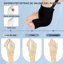 Corrector Ortopédico Juanete Dedo Del Pie Separador Valgus, aparatos ortopédicos para los dedos del pie, negro - Ver 4