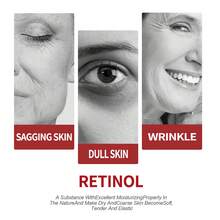 Unisex 1.06oz Retinol Collagen Complex Day & Night Cream With Licorice Root Extract, Moisturizing, Retinol, Glycerin, Vitamin E, Vitamin C, Vitamin B5, Vitamin A, Vitamin B3, Vitamin B2, Vitamin B1, Vitamin B6, Vitamin B12, Vitamin B9 - Cream - View 3