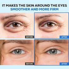 视黄醇眼霜：减少细纹，消除眼袋，滋润眼周肌肤 - 多色 - 查看 2