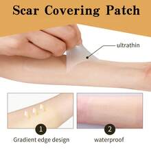 360pcs Transparent Round Multi-Functional Scar Covering Patches, Effectively Conceal Scars And Blemishes On Various Body Parts (Not For Cosmetic Purposes) - View 3