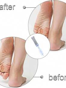 Foot Callus Remover Dead Skin Scraper Home Foot Care Heel Grinder Foot File Foot Scrubbing Board - One Size - View 9