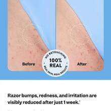 Peach Slices Smoothing Solution Ingrown Hair Treatment 3-Pack | Roll-On For Bikini Area, Razor Bumps & Redness | BHA, AHA, PHA, Niacinamide | Vegan, Cruelty-Free Korean Skin Care - Collagen - 查看 5
