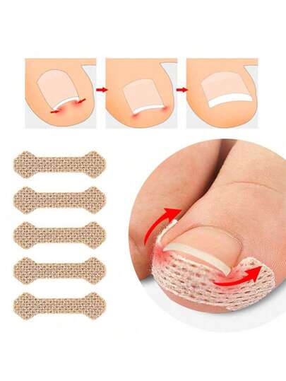 50PCS Nail Correction Stickers Ingrown Toenail Corrector Patches Treatment Recover Corrector Pedicure Care Tool