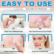 800/400/200 Pieces/Box Of Hydrogel Acne Patch, Alcohol Free, Odor Free, Mild And Non Irritating, High-Quality Tea Tree Oil Acne Patch To Cover Acne Scars, Suitable For Use On Skin, Available Day And Night - Multicolor - View 9
