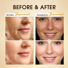 2.5%视黄醇抗衰老面部精华液 30ml，蕴含维生素E和透明质酸，抗皱深层补水，适合所有肤质。 - Retinol - 查看 7