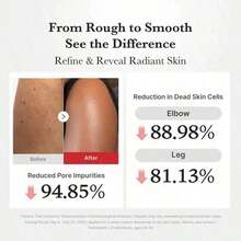 Meeeedicub Hypochlorous Acid Rice Peel Shot Duo For Face & Body | Gentle Exfoliating Serum For Dead Skin Cells & Pore Care, Blackheads & Excess Sebum Control | Rice Extract, Hypochlorous, Panthenol For Hydrating & Smoothing Care - 1件 - 查看 4