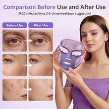 LED Face Mask Red Light Therapy For Face, Blue Light Acne Care, 180 LED Facial Mask With Eye Heat, Electric Face Mask With Charging Stand For Home Skincare, Purple Beauty Device - 美規A型插(110-127V) - 查看 5