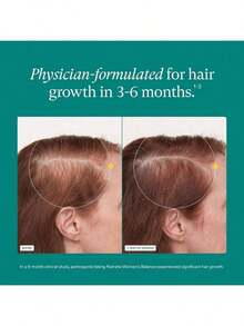 Women's Balance Hair Growth Supplements, Ages 45 And Up, Clinically Proven For Visibly Thicker Hair And Scalp Coverage In 3-6 Months, Dermatologist Recommended - 1 Month Supply Refill Pouch - 1 - Xem 3