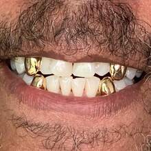 THATBOY 4pcs Fashion Personality Jewelry Grillz Single Glossy Copper Simple Cool Grillz Gift For Men And Women - Multicolor - View 6