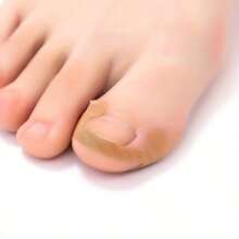 32pcs Nail Stickers Without Glue, Comfortable & Breathable Toe Nail Care Stickers, Firmly Adhesive - Multicolor - View 5