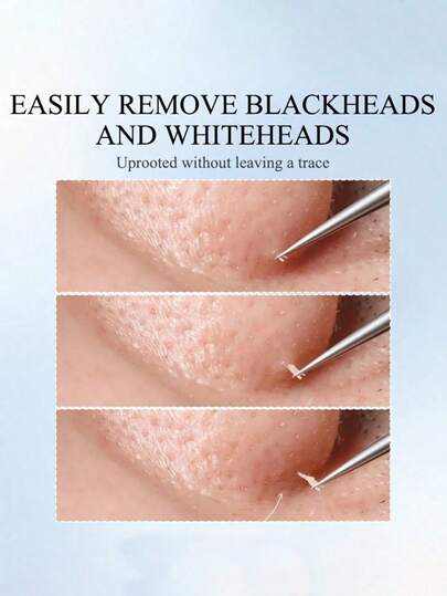 3pcs Stainless Steel Blackhead Removal Tool Set, Pimple Needle Blackhead Tweezers, Facial Cleaning Tools, Nose Cleansing Tools, Stainless Steel Blackhead Extractor Tweezers, Precision Tweezers - Ultra Fine Tip, High Hardness Stainless Steel Blackhead Remover Tweezers, Acne Treatment Tools, Blackhead Remover, Eyebrow Tweezers, Strong Hair And Beard Tweezers