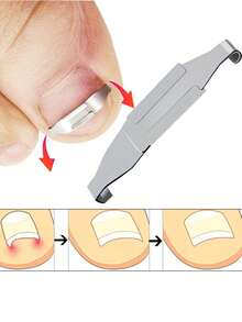 2pcs Ingrown Toenail Correction Tool, Painless Nail Repair, Suitable For Men And Women, Elegant Gift Pedicure - Multicolor - View 5