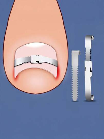 2件套嵌甲矫正工具，无痛指甲修复，男女通用，精美礼品