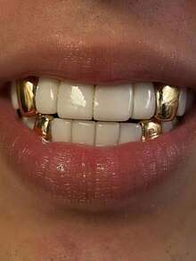 THATBOY 4pcs Fashionable Personalized Grillz, Single Shiny Bronze Minimalist Cool Grillz, Unisex Gift - Multicolor - View 13