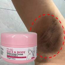 MELAO 美白霜，面部及身体亮白霜，快速美白保湿，均匀肤色，淡化色斑，蕴含植物萃取精华，适合所有肤质，100克/3.53盎司 - 粉色 - 查看 4