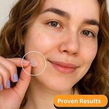 24pcs Acne Patches, Transparent Round Scar Covering Stickers, Multi-Functional Scar Concealer, Invisible Body Blemish Concealer (Non-Cosmetic) Acne Patches - View 3