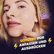 372片透明圆形疤痕遮盖贴，多功能疤痕遮盖贴，隐形身体瑕疵（非化妆品） - 查看 6