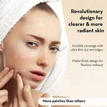 200pcs Scar Cover Patches, Conceal Scars, Invisible Body Blemish, Acne Stickers (Non-Cosmetic) - View 3