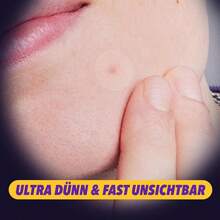 400片透明圆形疤痕遮盖贴，遮盖疤痕和身体瑕疵（非化妆品），祛痘贴 - 查看 7