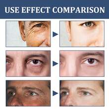 EAST MOON Men Facial Moisturizer Cream Smooth Wrinkle Firming Anti-Aging Face Neck Fine Lines Removal Shrink Pores Control Oil Lighten Dark Circles Eye Bags Even Skin Tone Refreshing Younger Multifunctional Skincare Products For Daily Use - Men's Facial Moisturizer Cream - View 4