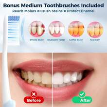 Oralphi Aluminum Toothbrush Travel Case With 2 Medium Bristle Toothbrushes, Portable Complete Toothbrush Travel Kit, Toothbrush Holder For Bathroom, Camping, Business Trip - ColorG - 查看 3