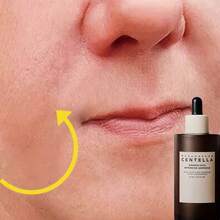 95毫升马达加斯加积雪草益生菌密集修护安瓶/护肤品，透明玻尿酸精华 - 蕴含积雪草成分，修护、舒缓、紧致、提亮肌肤 - Hyaluronic Acid - 查看 5